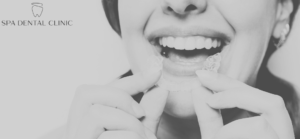 What Are Clear Aligners? Everything You Need to Know