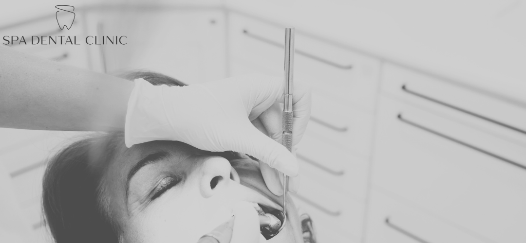 tooth hurts after filling - photo during filling treatment