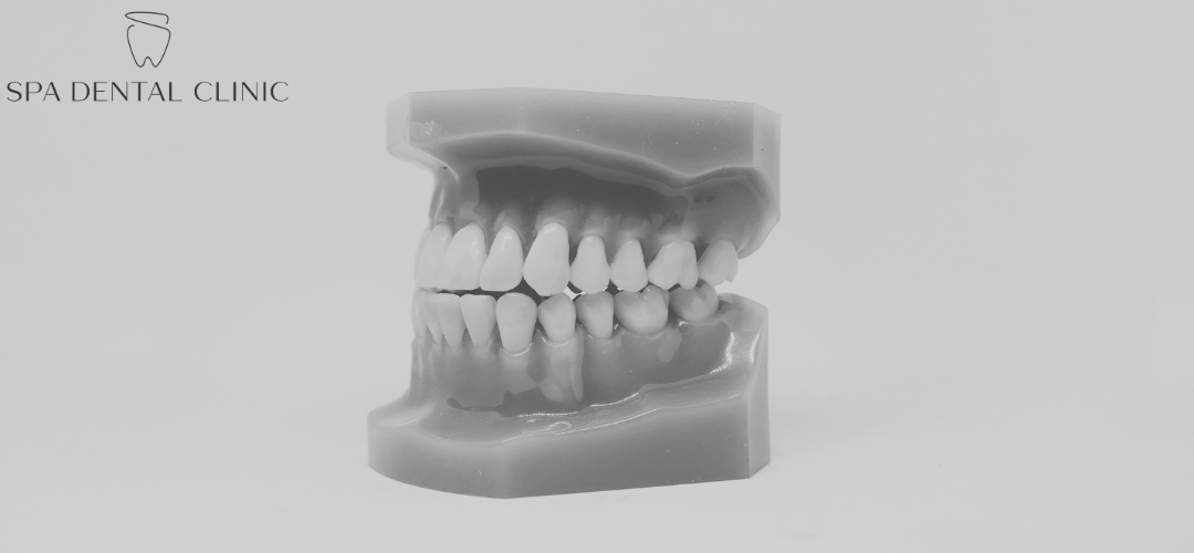 what is occlusion - blog explaining what occlusion is in dentistry
