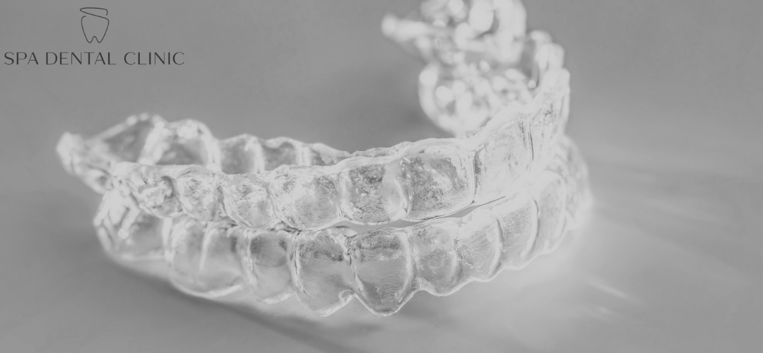 how to clean retainers - cover photo blog
